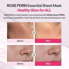 Load image into Gallery viewer, Mediheal Rose PDRN Essential Mask_Healthy Glow 24ml - 1 Sheet