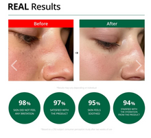 Load image into Gallery viewer, Dr.G Red Blemish Clear Soothing Cream 70ml