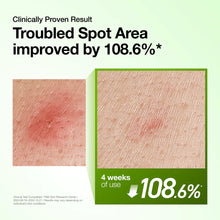 Load image into Gallery viewer, Anua Azelaic Acid 10 Hyaluron Redness Soothing Serum 30ml