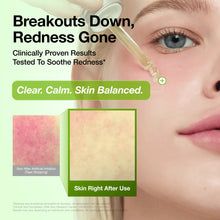 Load image into Gallery viewer, Anua Azelaic Acid 10 Hyaluron Redness Soothing Serum 30ml