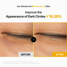 Load image into Gallery viewer, MEDIHEAL Collagen Capsule Patch Vitamin C Firm Brightening 60 Patches
