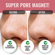 Load image into Gallery viewer, LOOK AT ME Nose Pore Strips Charcoal(BOX) - 5PCS
