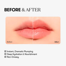 Load image into Gallery viewer, VT Reedle Shot Lip Plumper 4ml - Expert
